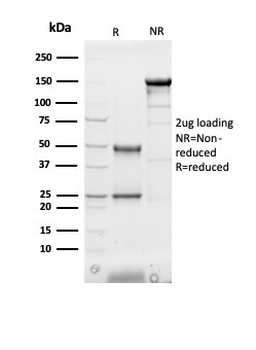 Heart Fatty Acid Binding Protein (H-FABP) / FABP3 Antibody