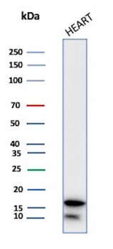 Heart Fatty Acid Binding Protein (H-FABP) / FABP3 Antibody