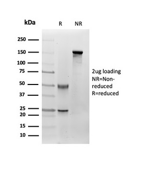 Fibroblast Activation Protein Alpha / FAP-1 Antibody