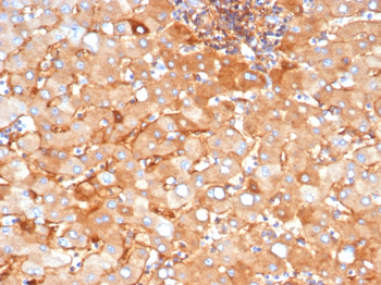 A2M Antibody