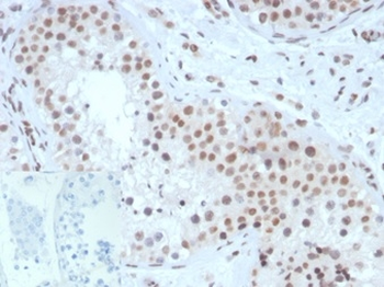 Steroidogenic Factor 1 (SF-1) (Transcription Factor) Antibody