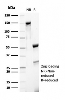 Recombinant MSH6 (DNA Mismatch Repair Protein) Antibody