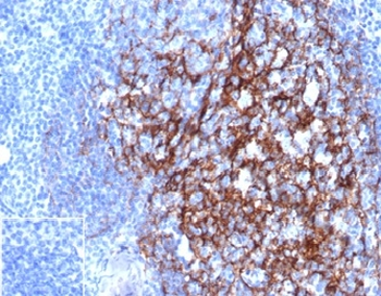 FCER2 Antibody