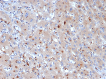 Alpha-1-Antichymotrypsin (SERPINA3) (Histiocytoma Marker) Antibody