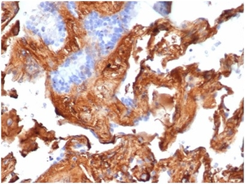 Fn1 Antibody