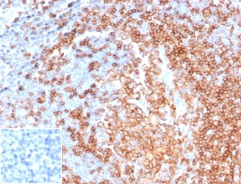 Recombinant CD22 / BL-CAM (B-Cell Marker) Antibody