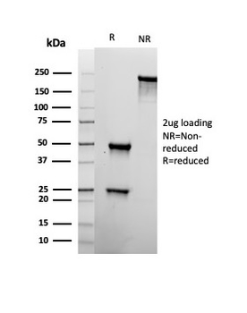 Recombinant CD22 / BL-CAM (B-Cell Marker) Antibody