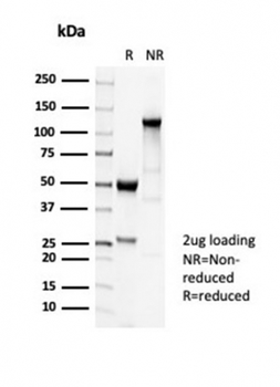 Recombinant Tubulin beta 3 / TUBB3 (Neuronal & Stem Cell Marker) Antibody