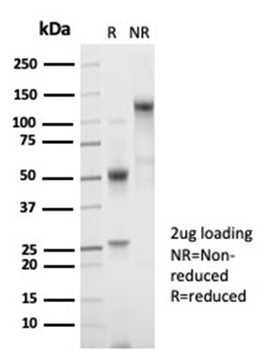 Recombinant Beta-2 Microglobulin (Renal Failure & Tumor Marker) Antibody