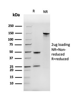 Nucleoside Diphosphate Kinase A / nm23-H1 Antibody