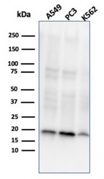 Nucleoside Diphosphate Kinase A / nm23-H1 Antibody