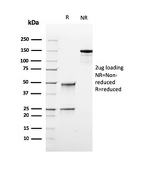 Recombinant Topoisomerase I, Mitochondrial (TOP1MT) Antibody