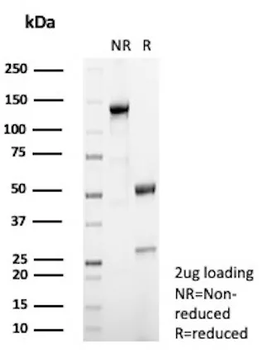 Recombinant Steroidogenic Factor 1 (SF-1) Antibody
