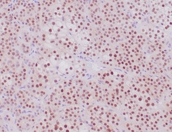 Recombinant Steroidogenic Factor 1 (SF-1) Antibody