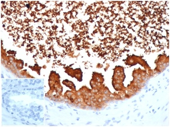 Lactotransferrin / Lactoferrin / LTF Antibody