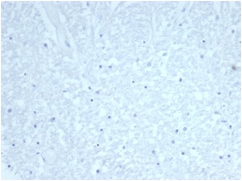 Recombinant Cdc20 (Cell Division Cycle Protein 20) Antibody
