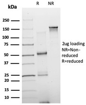 NEUROD2 (Neurogenic Differentiation 2) (Transcription Factor) Antibody