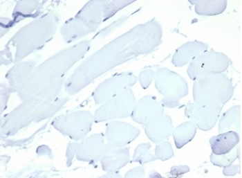 Recombinant Nucleolin (Marker of Human Cells) Antibody