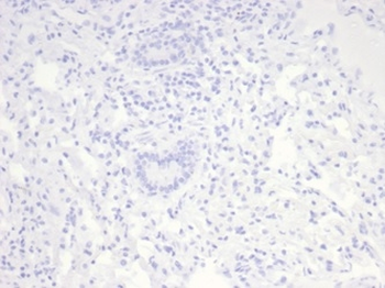 Recombinant Nucleolin (Marker of Human Cells) Antibody