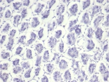 Recombinant Nucleolin (Marker of Human Cells) Antibody