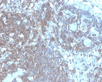 CD48 (Pan Leukocyte Marker) Antibody