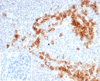 Recombinant CD38 (ADP Ribosyl Cyclase I) Antibody