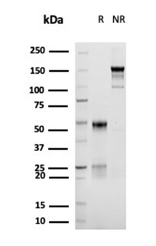 Recombinant CD30/ TNFRSF8 (Hodgkin &Reed-Sternberg Cell Marker) Antibody