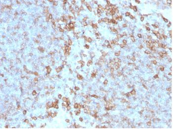 CD27 (Tumor Necrosis Factor Receptor Superfamily 7) Antibody