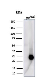 Recombinant CD3e (T-Cell Marker) Antibody