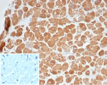 ACTN2 Antibody