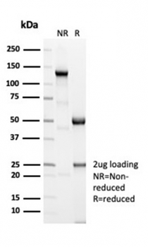ACTN2 Antibody