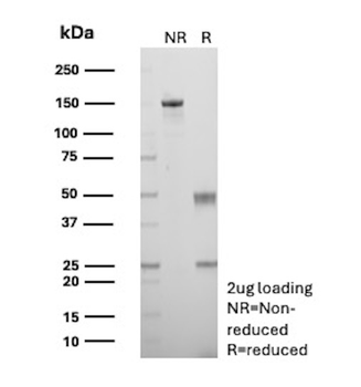 Recombinant Caldesmon, HMW (h-Caldesmon) (Smooth Muscle Marker) Antibody