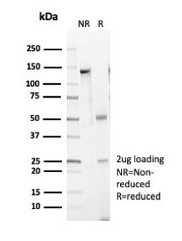 Recombinant Caldesmon, HMW (h-Caldesmon) (Smooth Muscle Marker) Antibody
