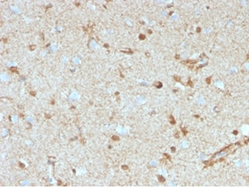 S100B (Astrocyte and Melanoma Marker) Antibody