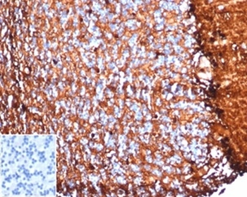 S100B (Astrocyte and Melanoma Marker) Antibody