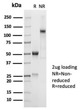 Recombinant CD45RA / LCA (B-Cell Marker) Antibody
