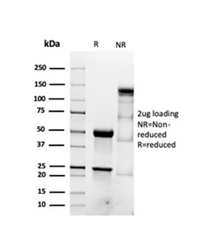 Recombinant Actin, Smooth Muscle (Leiomyosarcoma Marker) Antibody