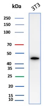 Recombinant Actin, Smooth Muscle (Leiomyosarcoma Marker) Antibody