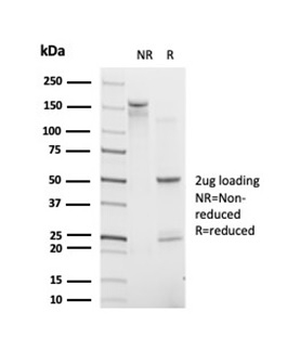 POLE3 / CHRAC17 Antibody
