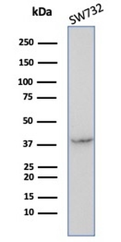SERPINB5 Antibody