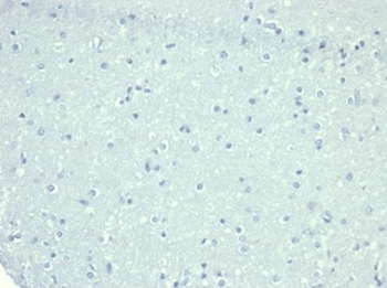 CD10 (Membrane Metalloendopeptidase) Antibody