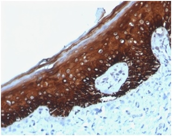 KRT14 Antibody
