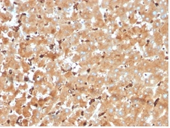 HP Antibody