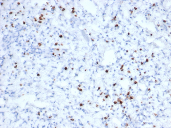 Recombinant Granzyme B (NK/T-Cell Lymphoma Marker) Antibody