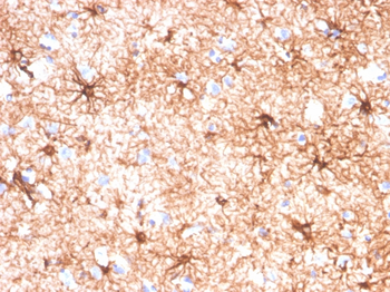 GFAP (Astrocyte & Neural Stem Cell Marker) Antibody