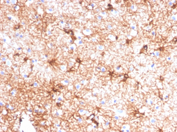 GFAP (Astrocyte & Neural Stem Cell Marker) Antibody