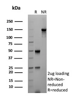 Recombinant Aldo-keto Reductase Family 1 Member B1 (Adrenal Marker) Antibody