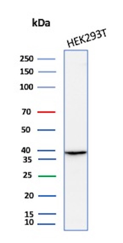Recombinant Aldo-keto Reductase Family 1 Member B1 (Adrenal Marker) Antibody