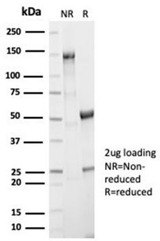 Recombinant Aldo-keto Reductase Family 1 Member B1 (Adrenal Marker) Antibody