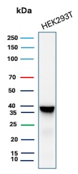 Recombinant Aldo-keto Reductase Family 1 Member B1 (Adrenal Marker) Antibody